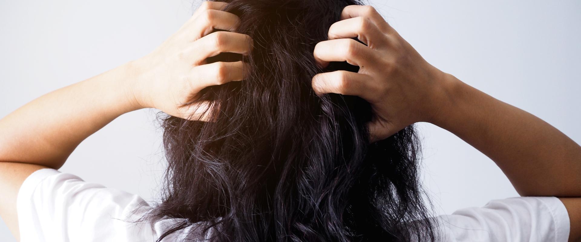 Jak oczyścić skórę głowy? Te 3 kosmetyki musisz mieć!
